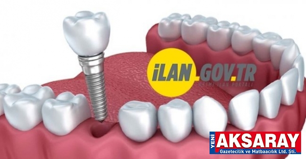 Dental implant satın alınacaktır