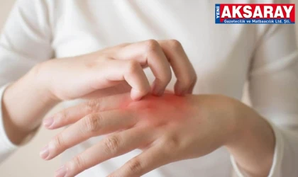 KIŞ EGZAMASINA DİKKAT! Aksaray’da ‘çat ayaz’ cildi vuruyor